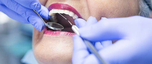 Best Emergency Tooth Extraction in Charlestown, MD